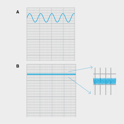 Esempio A: lampada a incandescenza in corrente alternata a bassa oscillazione di flusso luminoso; esempio B: apparecchio LED con leggero ripple: piccola e rapida oscillazione di flusso luminoso.